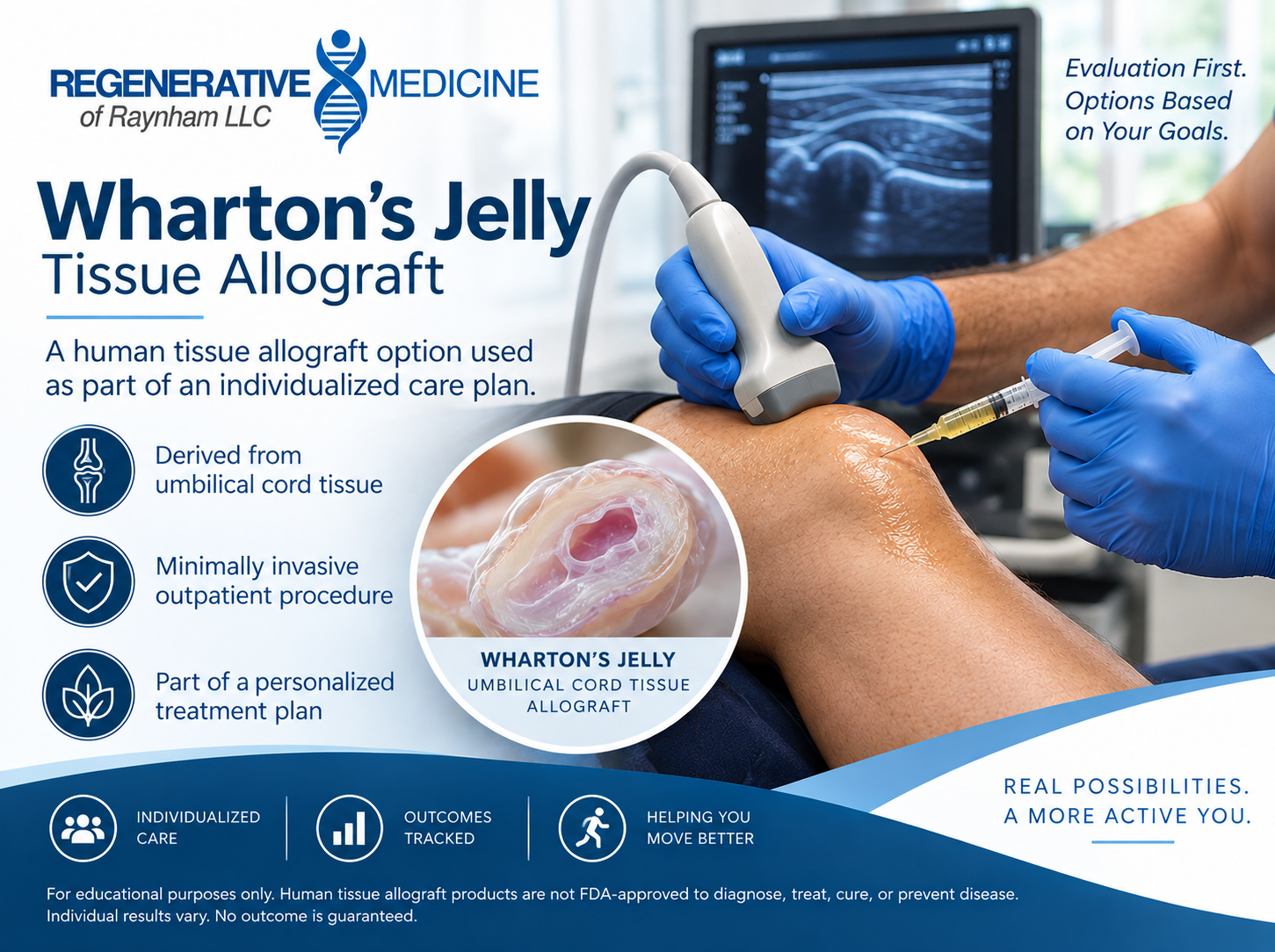 Educational overview of Wharton's Jelly tissue allograft: derived from umbilical cord tissue, used as part of a personalized regenerative care plan at Regenerative Medicine of Raynham.